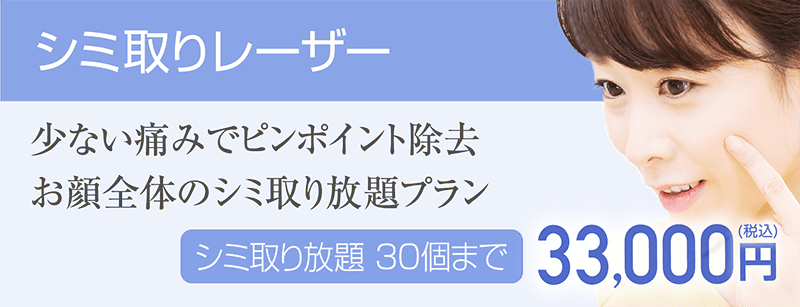シミ取りレーザー