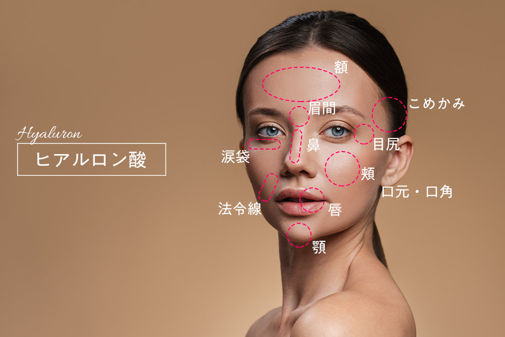 ヒアルロン酸 りんごクリニック